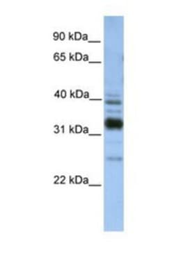 TMX4 Antibody, Novus Biologicals 0.05mg; Unlabeled:Antibodies, Polyclonal