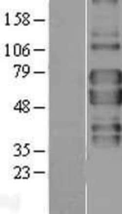 Novus Biologicals&trade;&nbsp;TNF RII/TNFRSF1B Overexpression Lysate