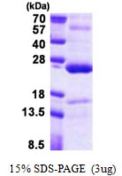 Novus Biologicals&trade;&nbsp;Recombinant Human TNFAIP8 His Protein
