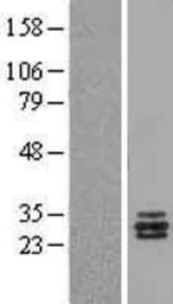 Novus Biologicals&trade;&nbsp;APRIL/TNFSF13 Overexpression Lysate