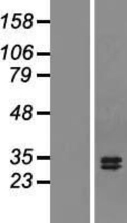 Novus Biologicals™ APRIL/TNFSF13 Overexpression Lysate