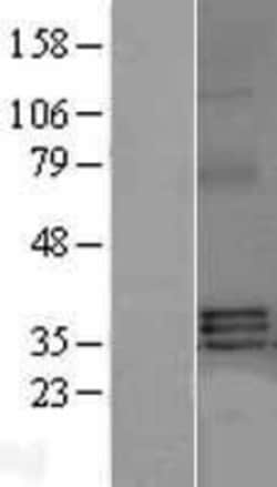 Novus Biologicals&trade;&nbsp;BAFF/BLyS/TNFSF13B Overexpression Lysate