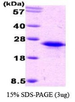 Novus Biologicals&trade;&nbsp;Recombinant Human BAFF/BLyS/TNFSF13B His Protein