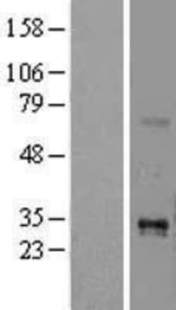 Novus Biologicals™ TL1A/TNFSF15 Overexpression Lysate