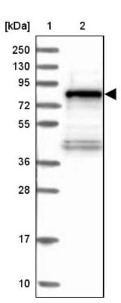 TNIP1 Antibody, Novus Biologicals 25 &mu;L, Unlabeled:Antibodies, Polyclonal