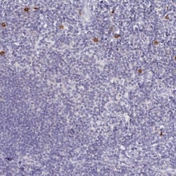 TNIP1 Antibody, Novus Biologicals 25 &mu;L, Unlabeled:Antibodies, Polyclonal