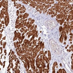 TNIP1 Antibody, Novus Biologicals 25 &mu;L | Buy Online | Novus Biologicals | Fisher Scientific