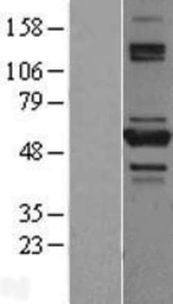 Novus Biologicals&trade;&nbsp;TNIP2 Overexpression Lysate