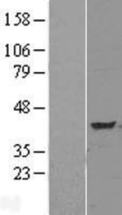 Novus Biologicals™ TNIP3 Overexpression Lysate