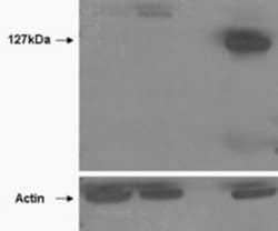 TNKS2 Antibody, Novus Biologicals 0.1mg; Unlabeled:Antibodies, Polyclonal