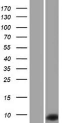 Novus Biologicals&trade;&nbsp;TNP1 Overexpression Lysate