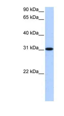 NLRP3/NALP3 Antibody (Nalpy3-b) - BSA Free, Novus Biologicals:Antibodies:Primary
