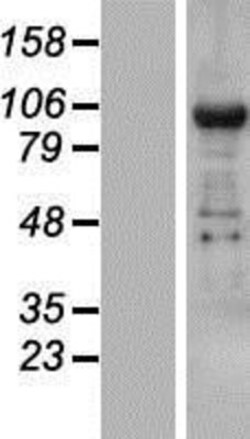 Novus Biologicals&trade;&nbsp;TNRC6B Overexpression Lysate