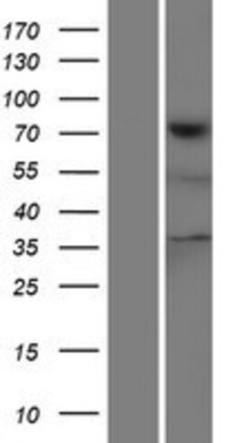 Novus Biologicals&trade;&nbsp;Tensin 4/CTEN Overexpression Lysate