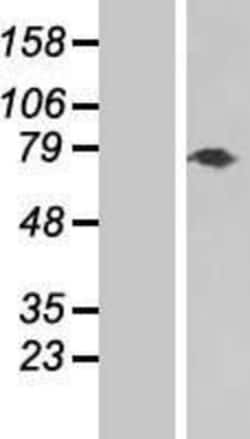 Novus Biologicals&trade;&nbsp;Tenascin X Overexpression Lysate