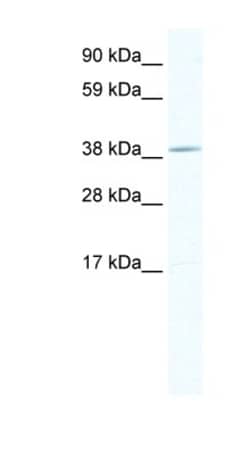 TOB1 Antibody, Novus Biologicals:Antibodies:Primary Antibodies