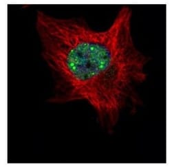 TOE1 Antibody, Novus Biologicals 0.1mL; Unlabeled:Antibodies, Polyclonal