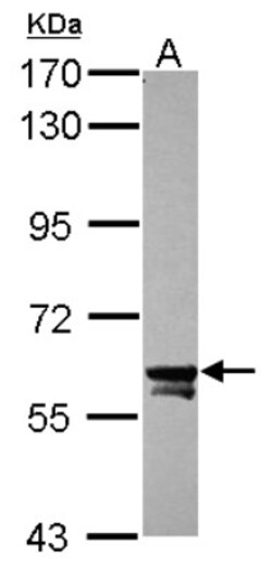 TOE1 Antibody, Novus Biologicals 0.1mL; Unlabeled:Antibodies, Polyclonal