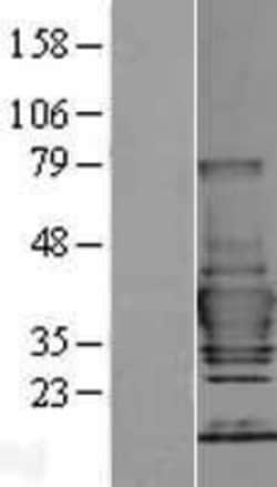 Novus Biologicals&trade;&nbsp;Tollip Overexpression Lysate