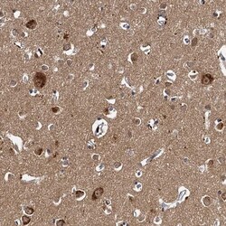 Tollip Antibody, Novus Biologicals:Antibodies:Primary Antibodies