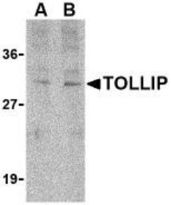 Tollip Antibody - BSA Free, Novus Biologicals 0.1mg; Unlabeled:Anticorps,