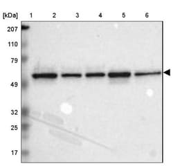 TOM1 Antibody, Novus Biologicals 0.1mL; Unlabeled:Antibodies, Polyclonal