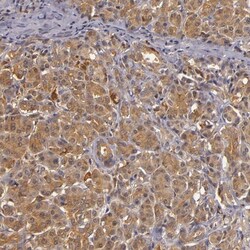TOM1 Antibody, Novus Biologicals 0.1mL; Unlabeled:Antibodies, Polyclonal