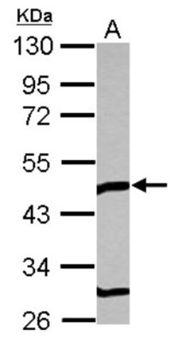 TOM1L1 Antibody, Novus Biologicals 0.1mL; Unlabeled:Antibodies, Polyclonal