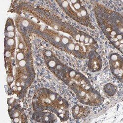 ZNF550 Antibody, Novus Biologicals:Antibodies:Primary Antibodies