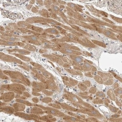 DPS Antibody, Novus Biologicals:Antibodies:Primary Antibodies