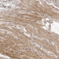 TOM1L2 Antibody, Novus Biologicals 25 &mu;L; Unlabeled:Antibodies, Polyclonal