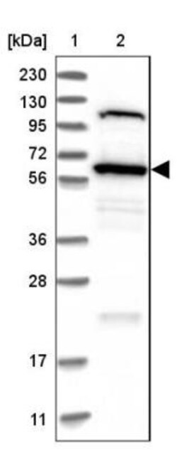 TOM1L2 Antibody, Novus Biologicals 25 &mu;L; Unlabeled:Antibodies, Polyclonal
