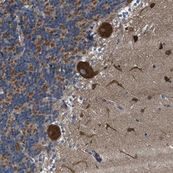 TOM70 Antibody, Novus Biologicals 0.1mL; Unlabeled:Antibodies, Polyclonal