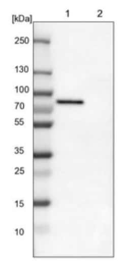 TOM70 Antibody, Novus Biologicals 0.1mL; Unlabeled:Antibodies, Polyclonal