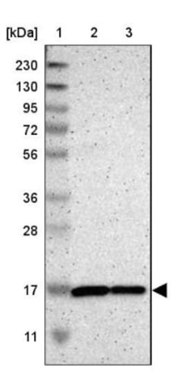TOMM20 Antibody, Novus Biologicals 0.1mL; Unlabeled:Anticorps, Polyclonal