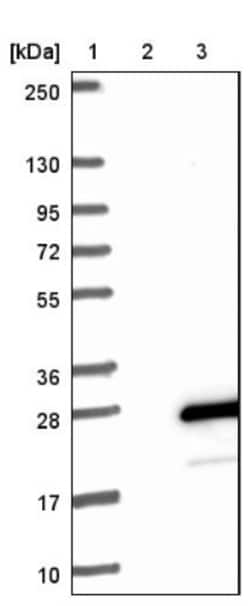 TOMM20L Antibody, Novus Biologicals 25 &mu;L | Buy Online | Novus Biologicals | Fisher Scientific
