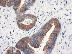 TOMM34 Antibody (OTI2A9), Novus Biologicals 0.1mL; Unlabeled:Antibodies,