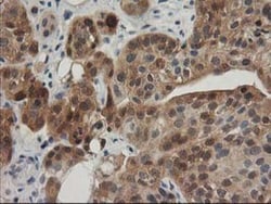 TOMM34 Antibody (OTI2A9), Novus Biologicals 0.1mL; Unlabeled:Antibodies,