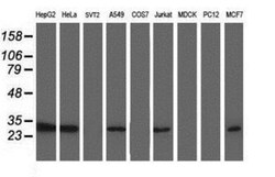 TOMM34 Antibody (OTI2A9), Novus Biologicals 0.1mL; Unlabeled:Antibodies,