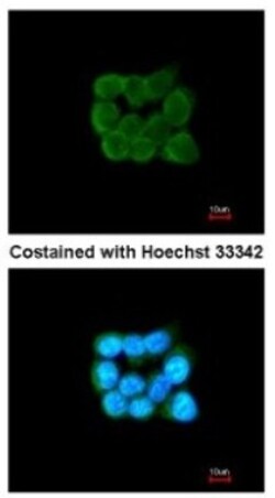 TOMM34 Antibody, Novus Biologicals 0.1mL; Unlabeled:Antibodies, Polyclonal