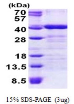 Novus Biologicals&trade;&nbsp;Recombinant Human TOMM34 His Protein