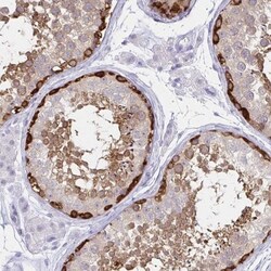 TOMM34 Antibody, Novus Biologicals 0.1mL; Unlabeled:Antibodies, Polyclonal
