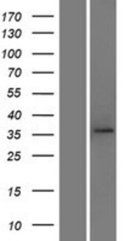 Novus Biologicals&trade;&nbsp;TOMM40 Overexpression Lysate