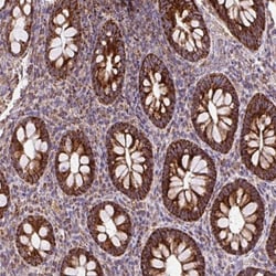 TOMM40 Antibody, Novus Biologicals:Antibodies:Primary Antibodies