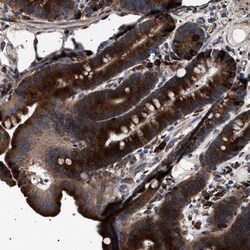 TOP1MT Antibody, Novus Biologicals:Antibodies:Primary Antibodies
