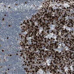 TOP2A Antibody, Novus Biologicals:Antibodies:Primary Antibodies