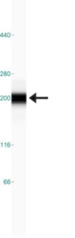 TOP2B Antibody, Novus Biologicals 0.1mL; Unlabeled:Antibodies, Polyclonal