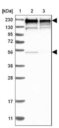 TOP2B Antibody, Novus Biologicals 0.1mL; Unlabeled:Antibodies, Polyclonal