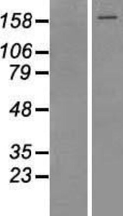 Novus Biologicals&trade;&nbsp;TOP2A Overexpression Lysate