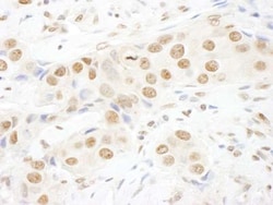 TOPORS Antibody, Novus Biologicals 0.1mL; Unlabeled:Antibodies, Polyclonal